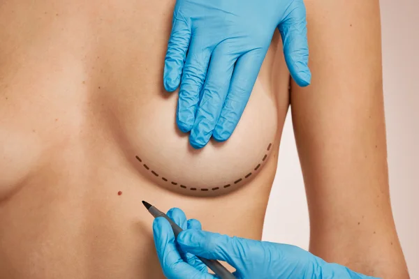 Silicone: respeitar tempo de recuperação evita deslocamento durante o sexo