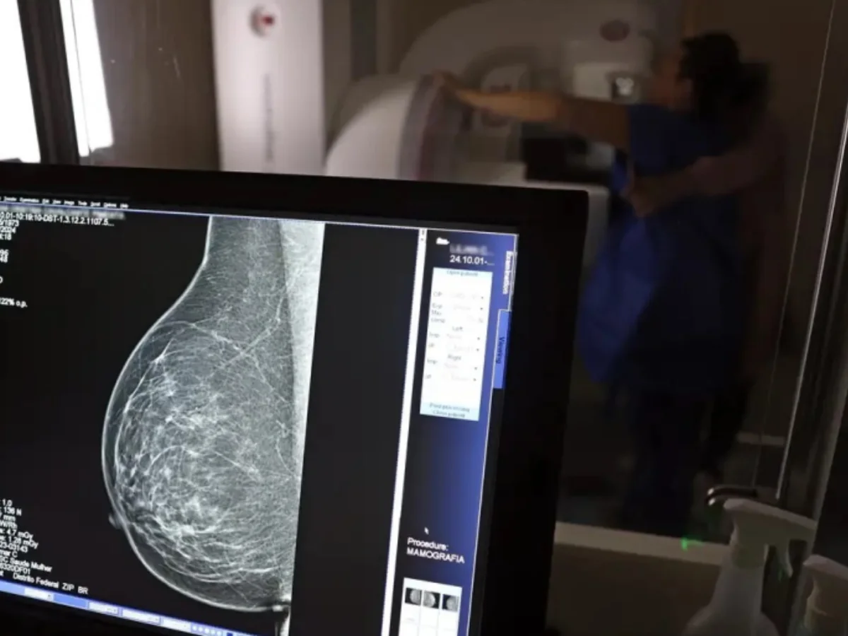 Outubro Rosa: tempo de espera por mamografia cai para 10 dias em BH